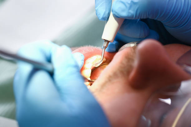 Best Pediatric Emergency Dentist in Sandusky, OH
